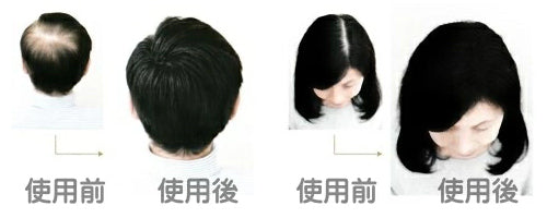 マイクロジェッター